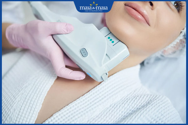 thực hiện ultherapy