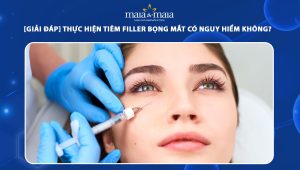 tiêm filler bọng mắt có nguy hiểm không
