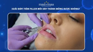 tiêm filler môi dày thành mỏng được không