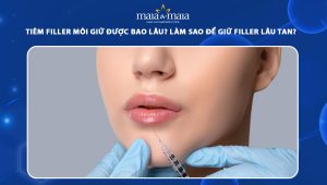 Tiêm filler môi giữ được bao lâu? Cách giữ filler lâu tan 64 tiêm filler môi giữ được bao lâu