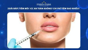tiêm môi 1cc