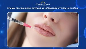 Tiêm môi tây căng mọng, quyến rũ: Xu hướng thẩm mỹ được giới trẻ ưa chuộng 87 tiêm môi tây