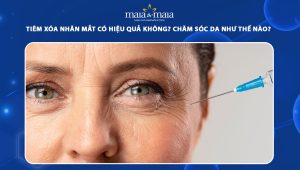 Tiêm xóa nhăn mắt có hiệu quả không? Chăm sóc da như thế nào? 103 tiêm xóa nhăn mắt