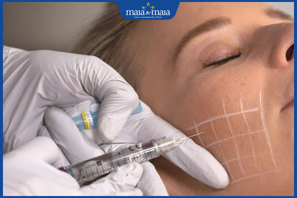 Có những liệu trình trẻ hóa da mặt nào? Lưu ý để đạt hiệu quả tốt nhất 3 tiến hành tiêm ha