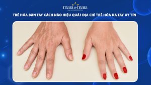 Trẻ hóa bàn tay cách nào hiệu quả? Địa chỉ trẻ hóa da tay uy tín 117 trẻ hóa bàn tay