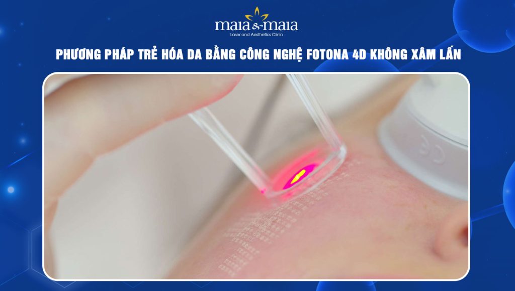 trẻ hóa da bằng công nghệ Fotona 4D