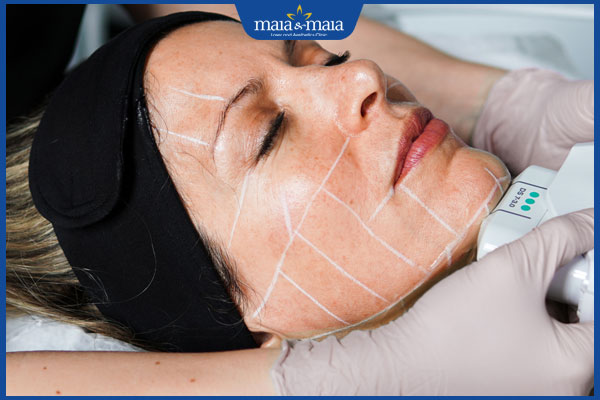 Điểm danh 10+ cách xóa nếp nhăn giúp làn da trẻ mãi 6 trẻ hóa da mặt với ultherapy