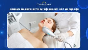 Ultherapy bao nhiêu line thì đạt hiệu quả cao? Lưu ý khi thực hiện 50 Ultherapy bao nhiêu line