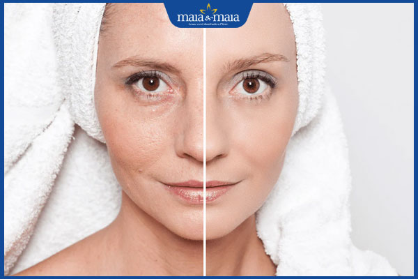 Trẻ hóa da bằng công nghệ Elight: Quy trình và lưu ý khi thực hiện 3 ưu điểm khi trẻ hóa da bằng công nghệ elight