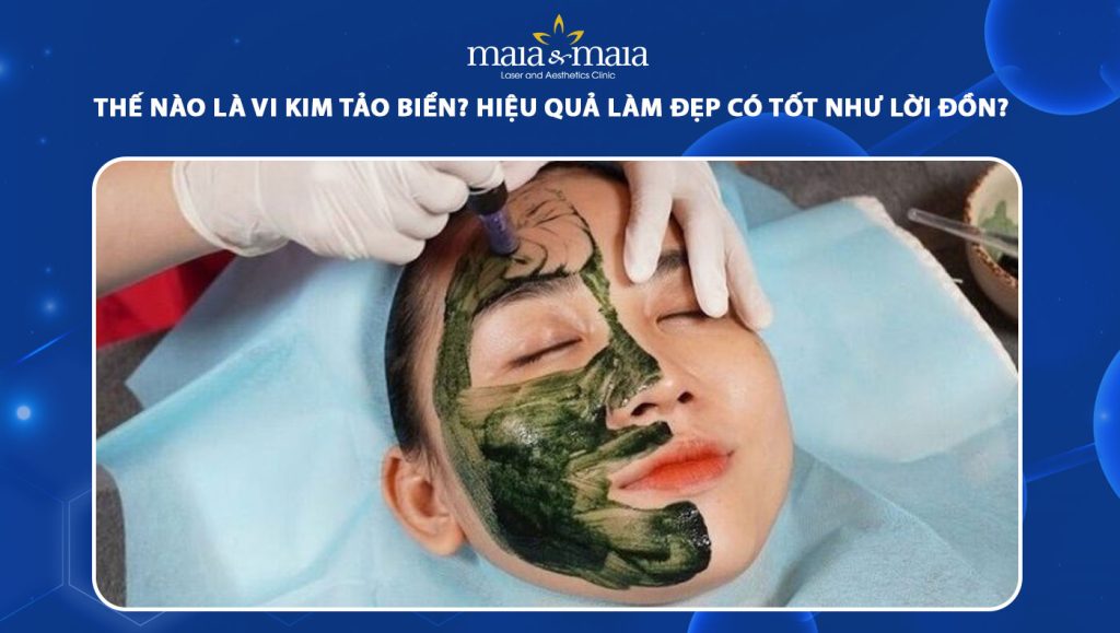 vi kim tảo biển