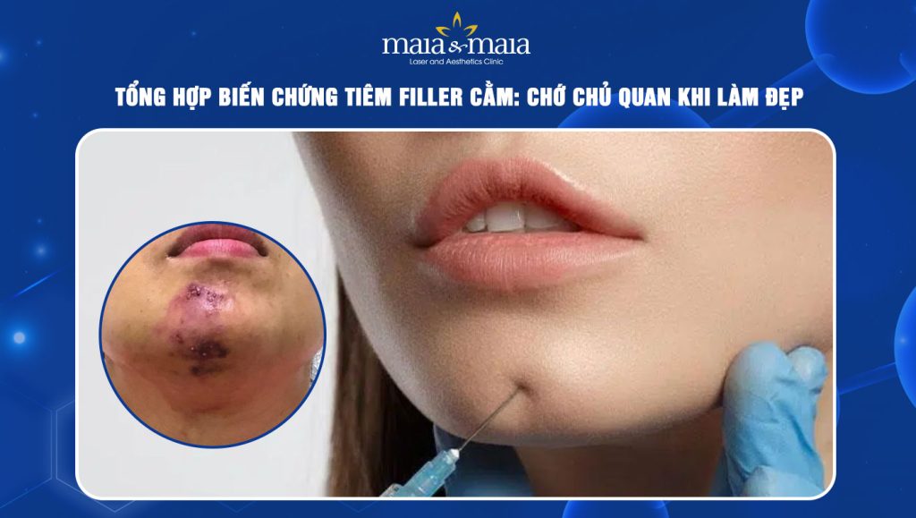 Biến chứng tiêm filler cằm