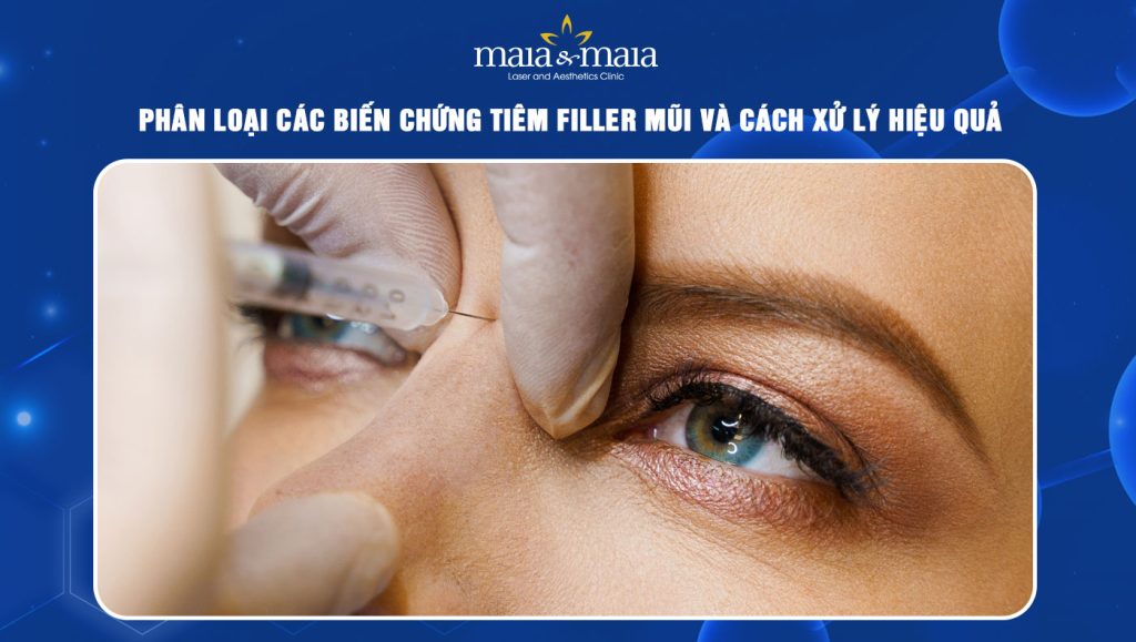 biến chứng tiêm filler mũi