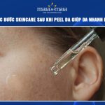 Các bước skincare sau khi peel da