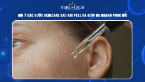 Gợi ý các bước skincare sau khi peel da giúp da nhanh phục hồi 92 Các bước skincare sau khi peel da
