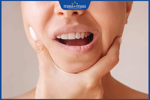 Tiêm filler cằm xong bị cứng do đâu? Cách giúp cằm nhanh vào form đẹp 2 cằm cứng sau tiêm