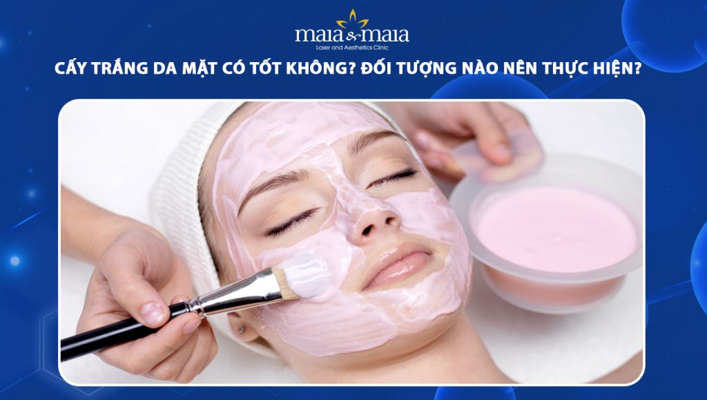 cấy trắng da mặt có tốt không
