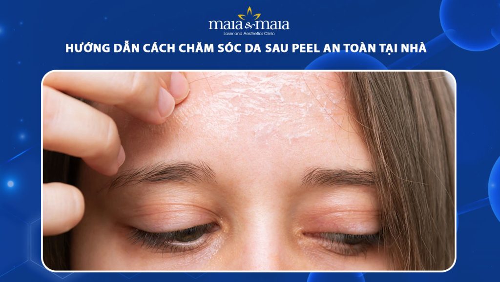 chăm sóc da sau peel