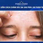 chăm sóc da sau peel
