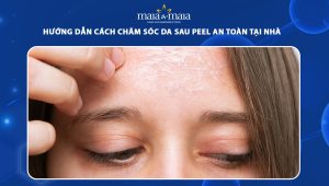 Hướng dẫn cách chăm sóc da sau peel an toàn tại nhà 89 chăm sóc da sau peel