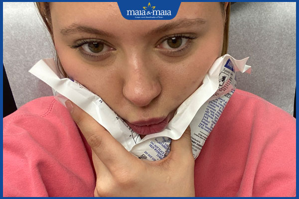 Tiêm filler cằm bị đỏ: Nguyên nhân, cách xử lý và hạn chế biến chứng 3 chườm lạnh ở cằm