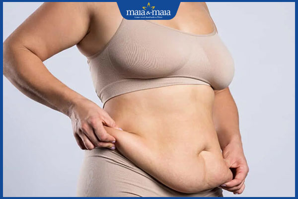 da chảy xệ gây khó chịu