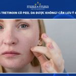 đang dùng tretinoin có peel da được không