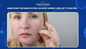Đang dùng tretinoin có peel da được không? Cần lưu ý gì khi peel để đảm bảo an toàn? 39 đang dùng tretinoin có peel da được không