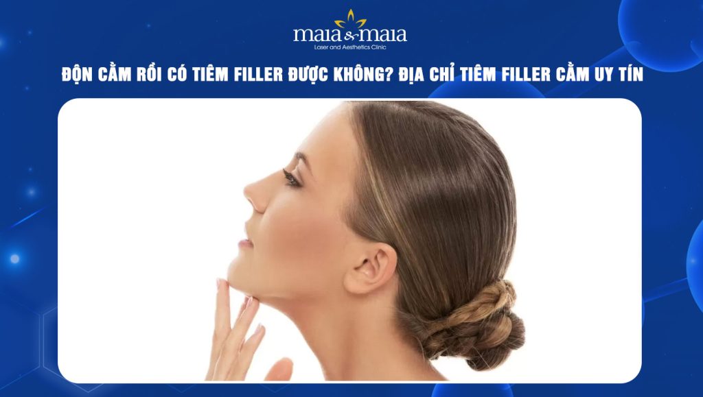độn cằm rồi có tiêm filler được không