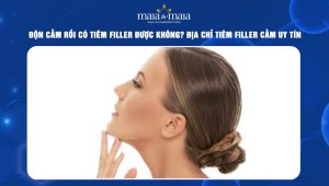 Độn cằm rồi có tiêm filler được không? Địa chỉ tiêm filler cằm uy tín 36 độn cằm rồi có tiêm filler được không