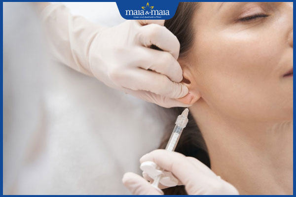 Có nên tiêm filler tai tài lộc không? Quy trình và chi phí thực hiện 5 giá tiêm tai tài lộc