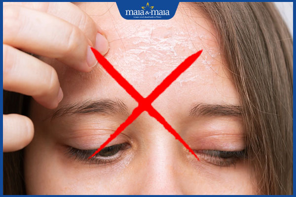 Làm sao để peel da nhanh bong? Tổng hợp 6 điều cần chú ý sau peel 4 không cạy bóc da