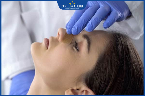 Tiêm filler mũi kiêng gì? Làm sao để dáng mũi nhanh ổn định? 2 kiêng cữ sau tiêm filler mũi