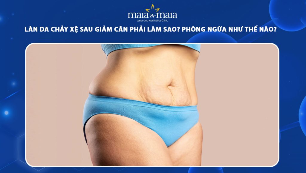 làn da chảy xệ sau giảm cân
