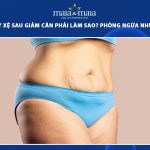 làn da chảy xệ sau giảm cân