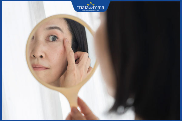 Da mỏng có peel được không? Tiết lộ giải pháp thẩm mỹ da an toàn, hiệu quả cao  2 làn da mỏng