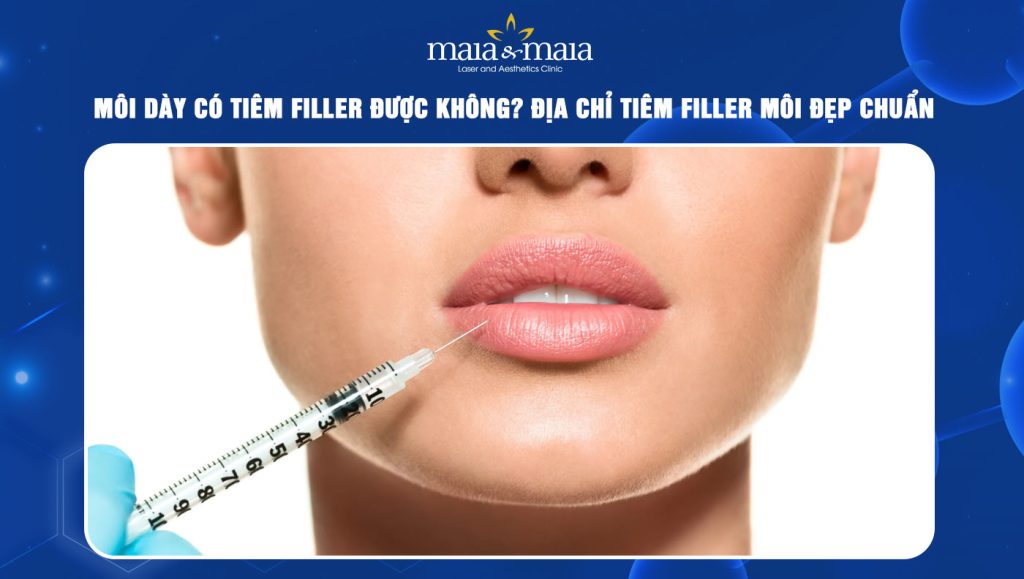 môi dày có tiêm filler được không