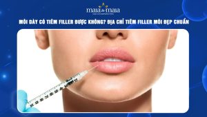Môi dày có tiêm filler được không? Địa chỉ tiêm filler môi đẹp chuẩn 45 môi dày có tiêm filler được không