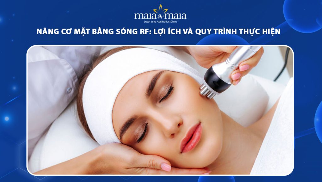 nâng cơ mặt bằng sóng RF