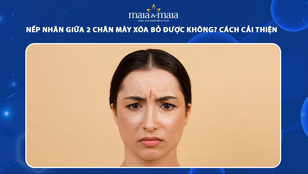 nếp nhăn giữa 2 chân mày