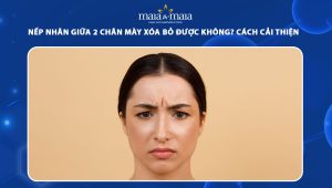 Nếp nhăn giữa 2 chân mày xóa bỏ được không? Cách cải thiện và phòng ngừa hiệu quả cao 57 nếp nhăn giữa 2 chân mày