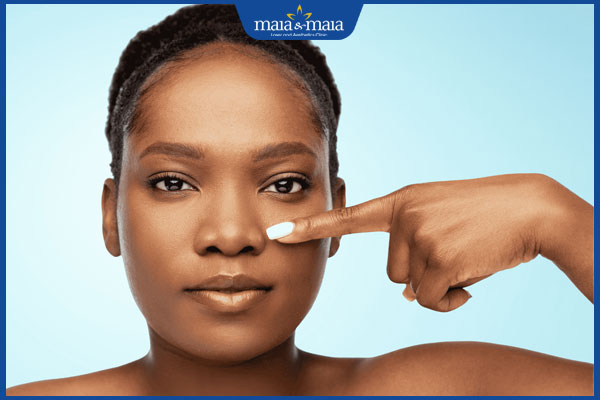 Tiêm filler mũi: Ưu, nhược điểm và quy trình thực hiện 3 người có mũi thấp