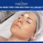 peel da bao nhiêu tiền
