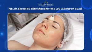 Peel da bao nhiêu tiền? Cảnh báo trào lưu làm đẹp da giá rẻ và nguy hiểm tiềm ẩn  70 peel da bao nhiêu tiền