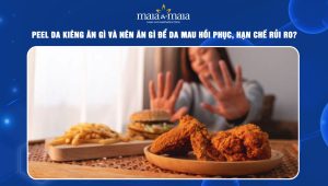 Peel da kiêng ăn gì và nên ăn gì để da mau hồi phục, hạn chế rủi ro? 40 peel da kiêng ăn gì