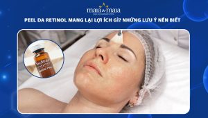 Peel da Retinol mang lại lợi ích gì? Những lưu ý nên biết 58 peel da retinol