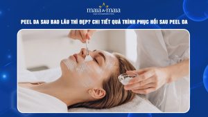 Peel da sau bao lâu thì đẹp? Chi tiết quá trình phục hồi sau peel da 47 peel da sau bao lâu thì đẹp