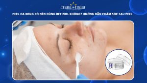 Peel da xong có nên dùng Retinol không? Hướng dẫn chăm sóc da sau peel đúng cách 67 peel da xong có nên dùng retinol