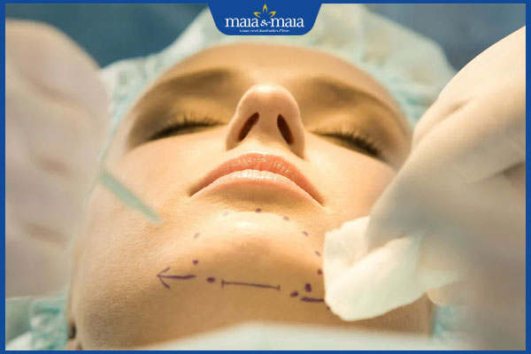 Độn cằm rồi có tiêm filler được không? Địa chỉ tiêm filler cằm uy tín 2 phẫu thuật độn cằm