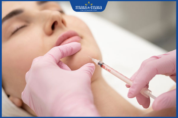 Tiêm filler cằm bao lâu thì đẹp? Các yếu tố ảnh hưởng là gì? 2 quy trình tiêm filler cằm