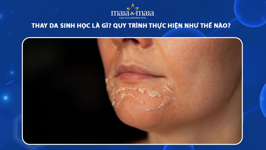 thay da sinh học